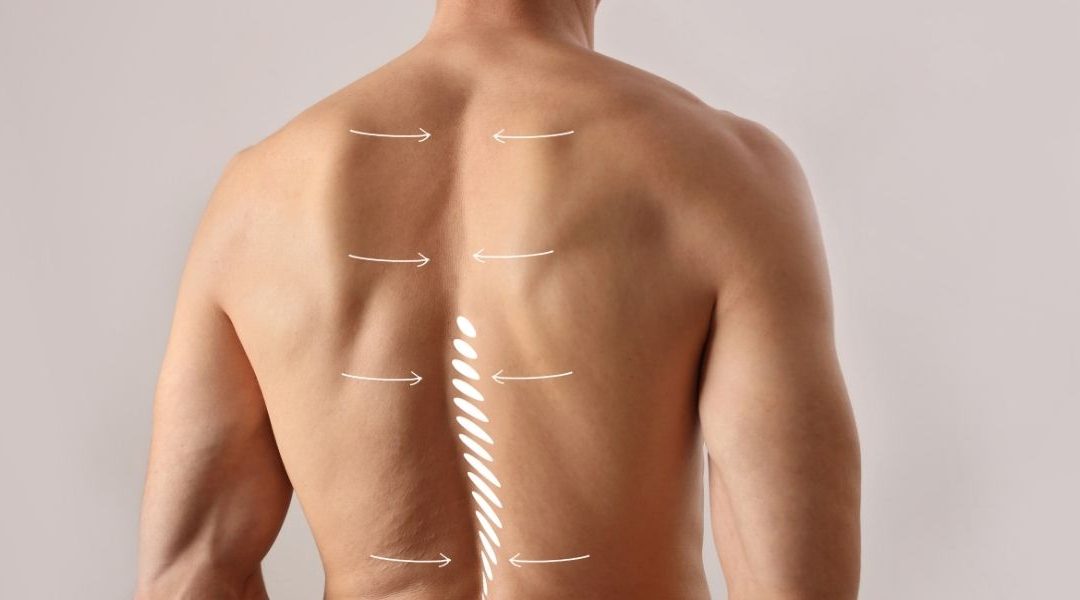 Méthode efficace pour corriger le dos rond sur les exercices